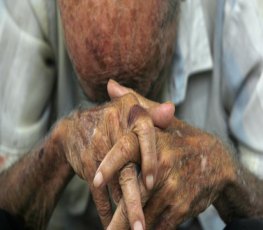 Idoso de 76 anos é internado após ser agredido por sobrinho 