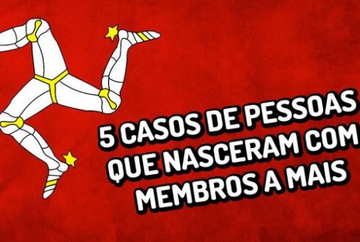 5 casos de pessoas que nasceram com membros a mais