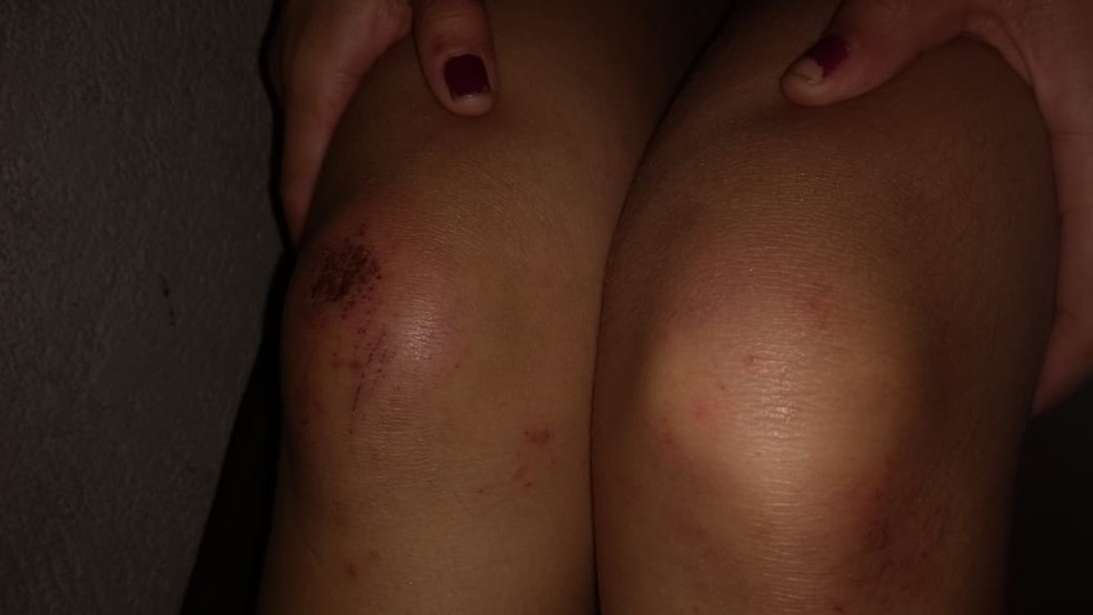 COVARDIA: Mulher é surrada por marido ciumento em residência na zona Leste 