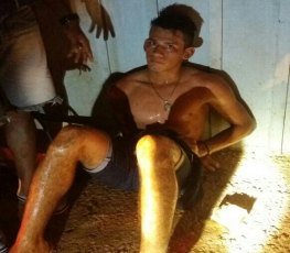 Após furtar residência, suspeito é atropelado e surrado por populares