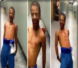 NO HOSPITAL - Homem baleado na boca é possuido pelo demônio – VÍDEO