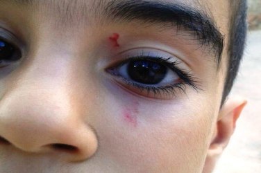 Pais acionam polícia após filho sofrer várias agressões em escola na capital