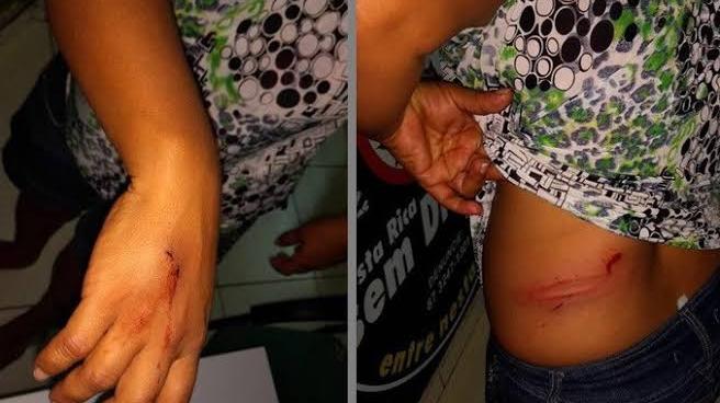 DESMAIADA: Mulher é atacada a facada e pauladas pelo ex-marido e enteado por causa de fofoca