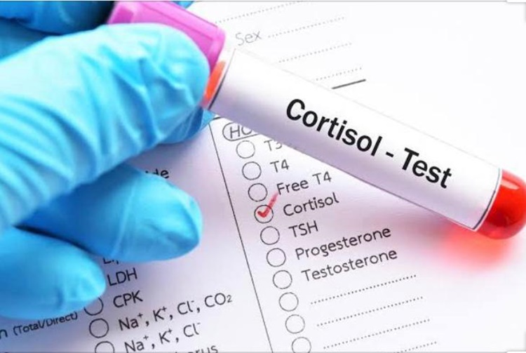 Modulação do cortisol - por Andreia Marri