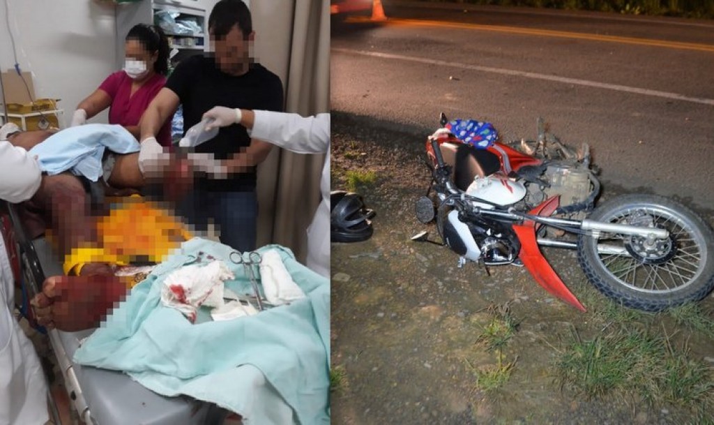 GRAVEMENTE FERIDO: Motociclista tem perna decepada em acidente na BR 364