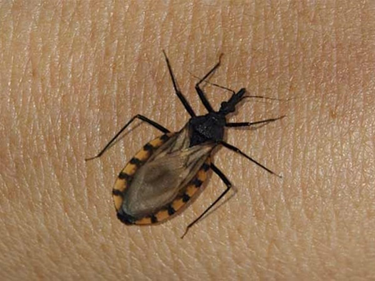 CIÊNCIA: Variante genética protege indígena da Amazônia contra doença de Chagas