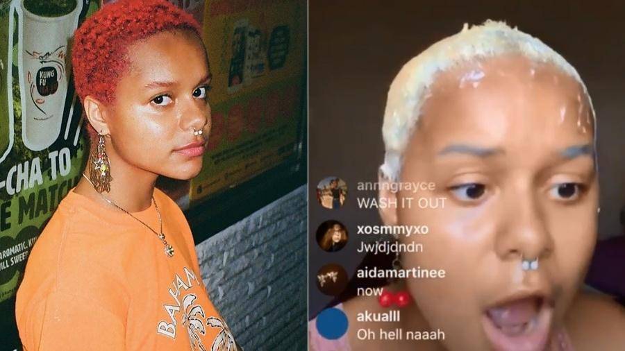 INSTAGRAM: Blogueira fica careca em live após alisamento dos cabelos em casa