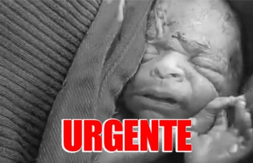 NÃO SUPORTOU: Bebê que 'ressuscitou' após ser declarado morto não resiste