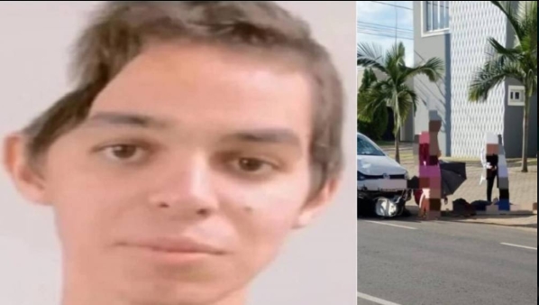 CIRURGIA CARA: Família vilhenense cria vaquinha para o tratamento de um jovem de 19 anos