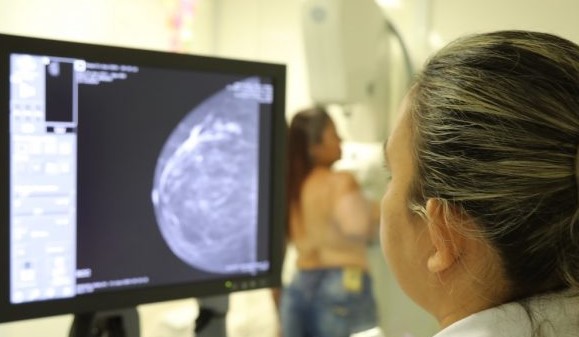 CARRETA DO AMOR: Unidade realiza exames preventivos em Jaru a partir do dia 19