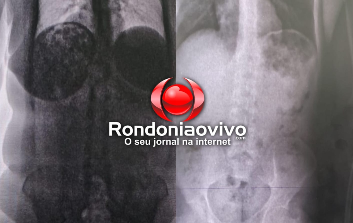 FISCALIZAÇÃO: Mães e esposas de apenados são obrigadas a traficar no presídio 603