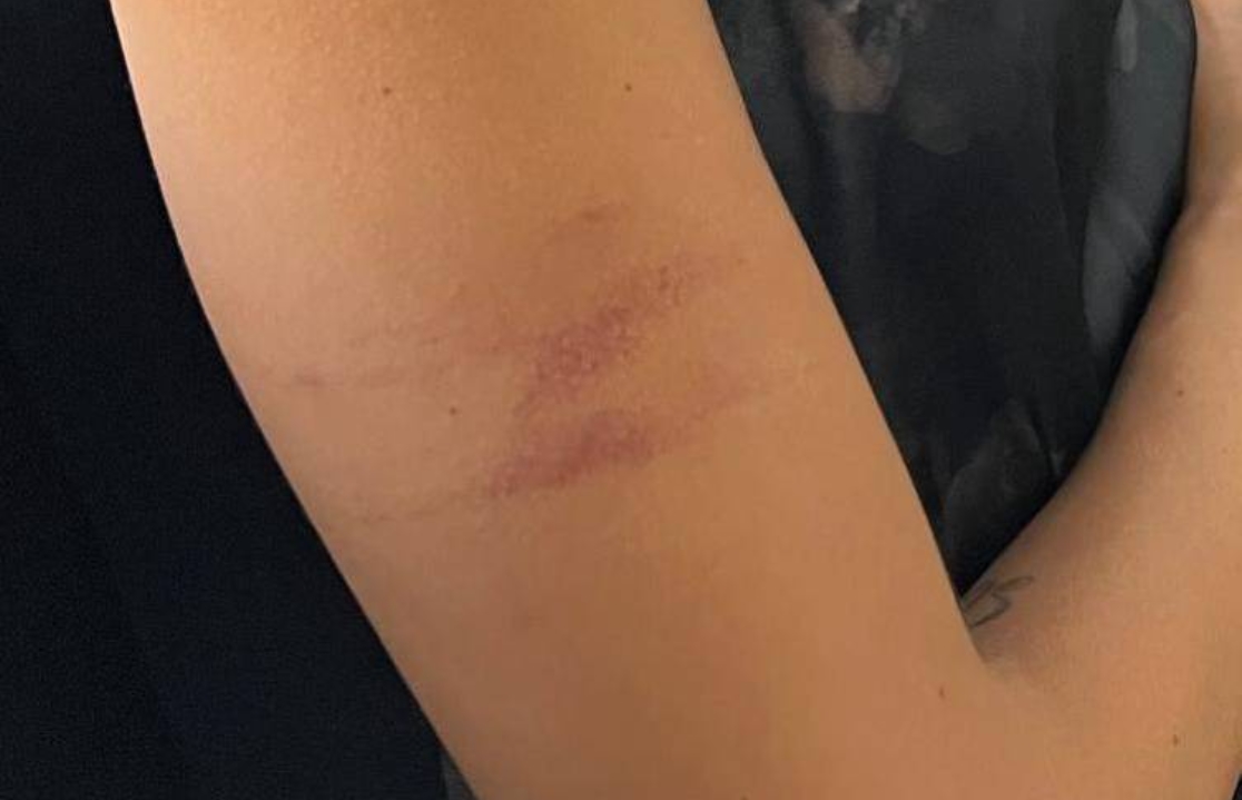 EM CÁRCERE: Mulher é socorrida após dois dias sendo agredida e abusada pelo ex-marido