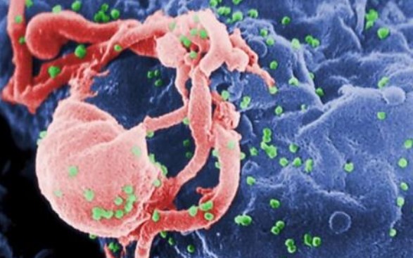 CIÊNCIA INTRIGADA: Mutação rara que dificulta infecção por HIV surgiu há milênios