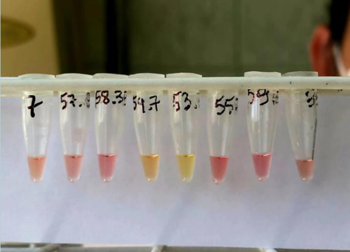 EM UMA HORA: Pesquisadora da UFSM é finalista com teste rápido para tuberculose