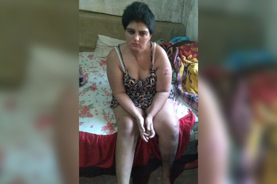 NA LUTA: Mulher que fez cirurgia após acidente, ainda precisa de ajuda para voltar a andar