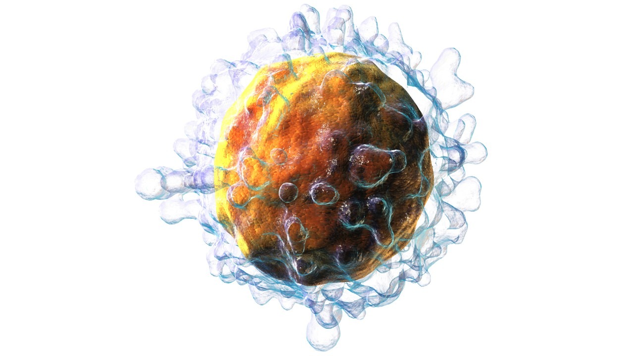 LEUCEMIA: Modificação torna ainda mais potente imunoterapia usada contra câncer no sangue  