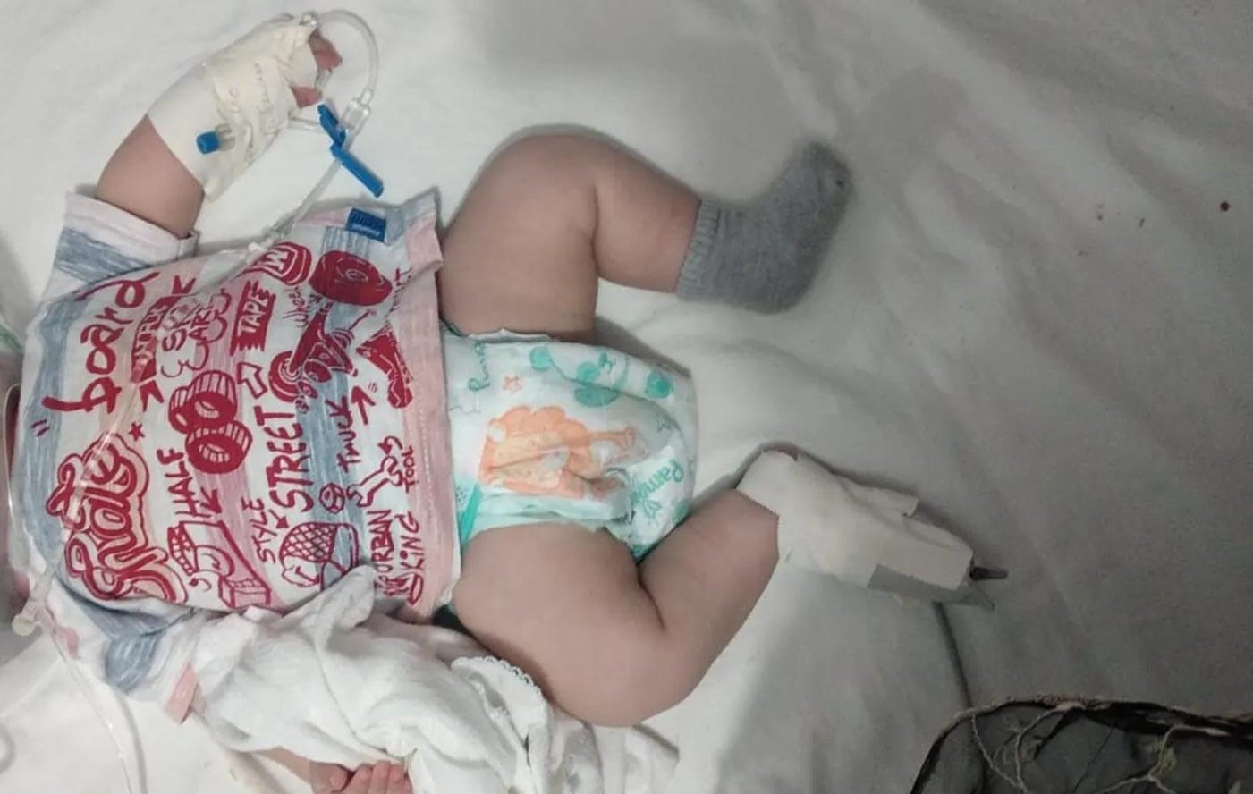 CAIU DA CAMA: Bebê tem crânio rachado e mãe é presa por levá-la no outro dia à UPA