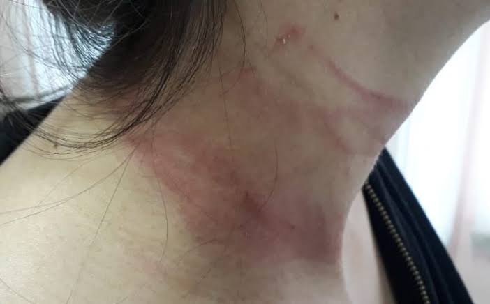 ZONA LESTE: Jovem é preso após pular muro de condomínio e agredir ex-mulher​