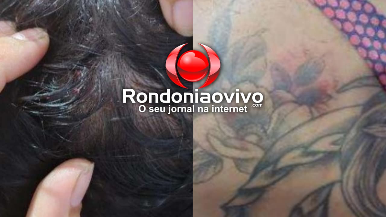 MARIA DA PENHA: Marido é preso por agredir mulher que se apresentou na Flor do Maracujá