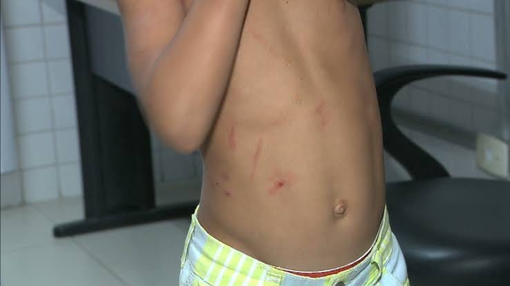 MAUS TRATOS: Mãe que agredia filho é espancada por vizinhas em condomínio