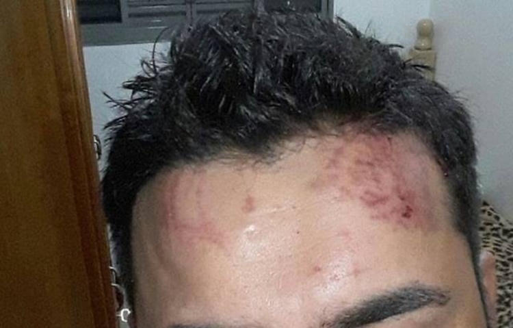 CORONHADAS: Briga entre vizinhos por causa de cachorro acaba com jovem agredido na cabeça