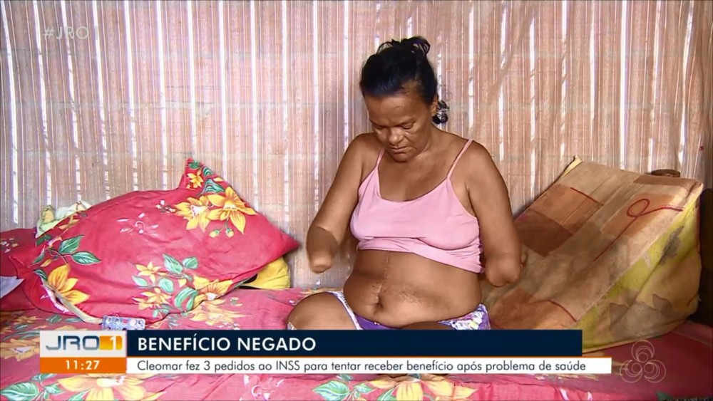 ABSURDO: Sem as mãos, mulher perde benefício do INSS por não assinar documentos