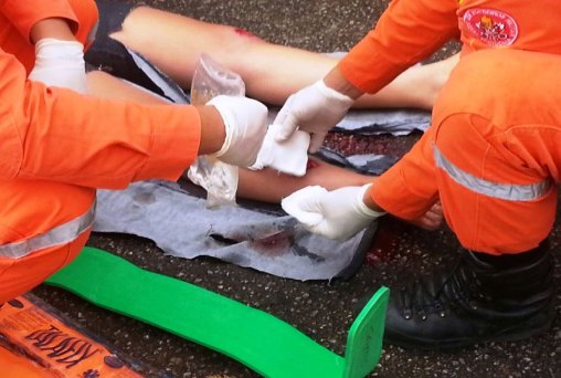 Motociclista sofre fratura exposta em colisão com automóvel 