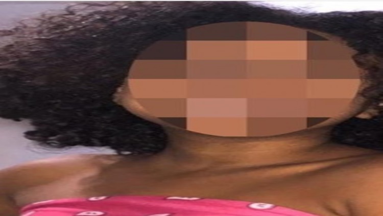 RACISMO: Menina de 11 anos vira suspeita de roubo por ter cabelo crespo e ser negra