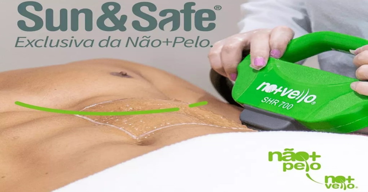 SUN E SAFE: Depilação com tecnologia de ponta é novidade na Não+Pelo