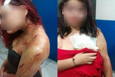 Duas mulheres são esfaqueadas por outra em baile na cidade