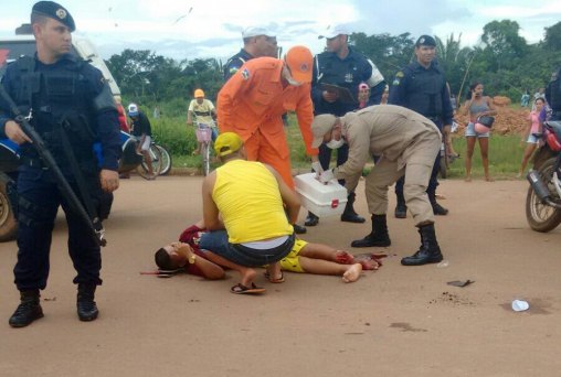 Adolescente tem perna dilacerada após acidente de moto
