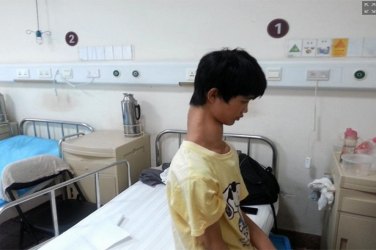 Cirurgia vai encurtar o pescoço de adolescente chinês