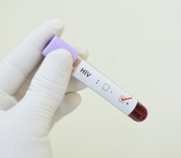 HIV: Cone Sul possui dois mil portadores do vírus