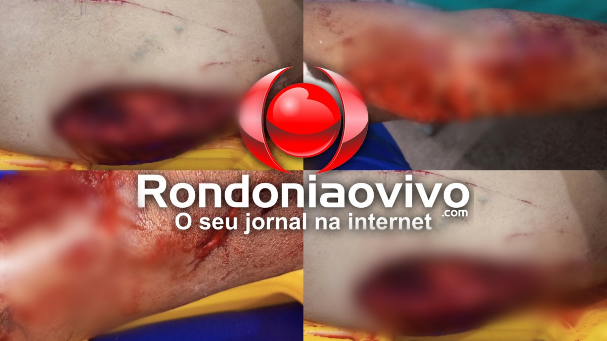 BRIGA INTENSA: Casal é preso após ficar gravemente ferido ao cair sobre vaso sanitário  