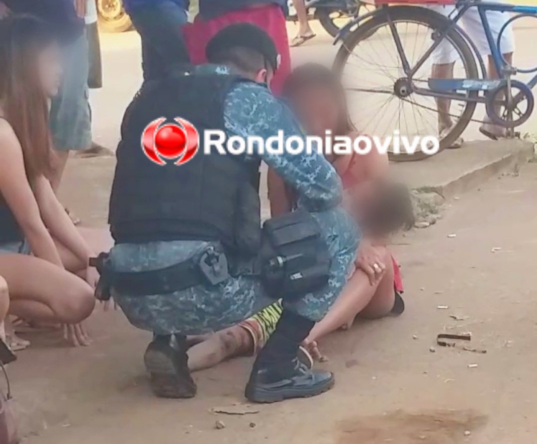 COLISÃO FRONTAL: Motociclista tem perna dilacerada em grave acidente envolvendo criança