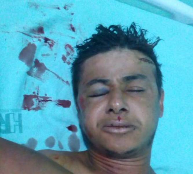 TENTOU FUGIR: Populares espancam homem que atropelou rapaz com problemas mentais