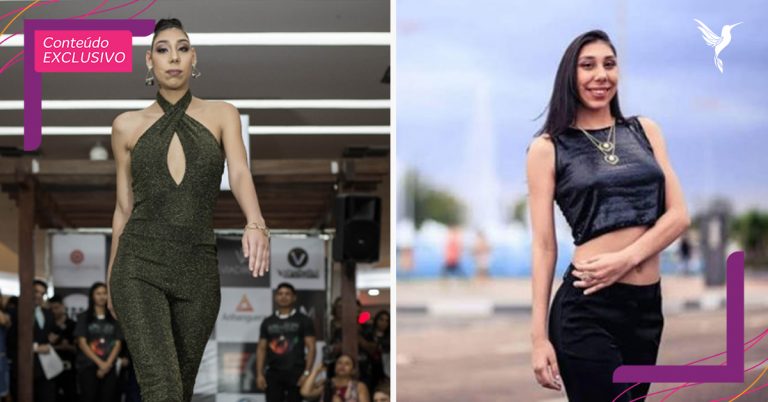 REPRESENTATIVIDADE: Ana Victória, a primeira modelo com microcefalia do Brasil e do mundo