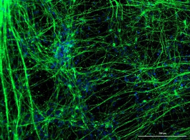 SISTEMA NERVOSO: Novo coronavírus pode infectar neurônios de seres humanos