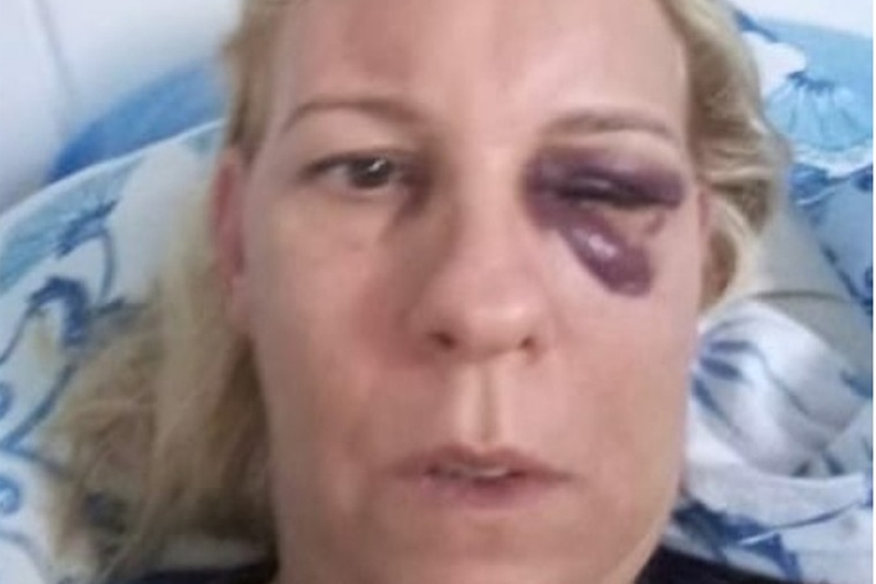 RELACIONAMENTO ABUSIVO: “Me achava culpada”, diz professora agredida pelo ex por quatro anos