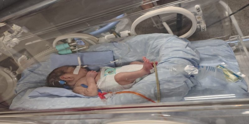 PREMATURO: Recém-nascido Davi Balestieri precisa de doação de plaquetas